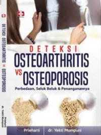 Deteksi osteoarthritis vs osteoporosis : Perbedaan, seluk beluk dan penanganannya